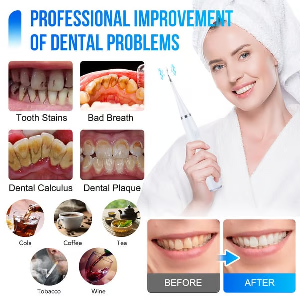 Electric Ultrasonic tooth cleaner -  Best gift for family and friends