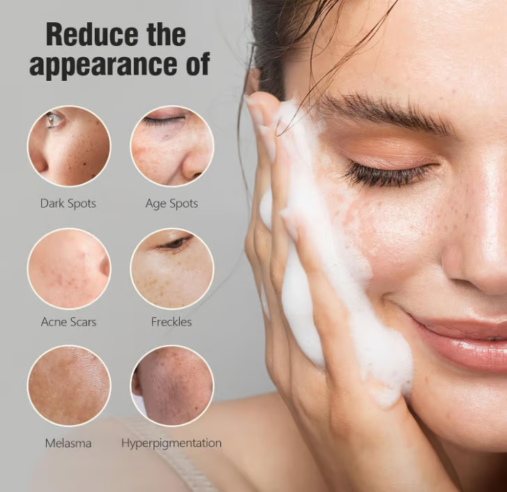 Kojic Acid Dark Spot Remover Soap